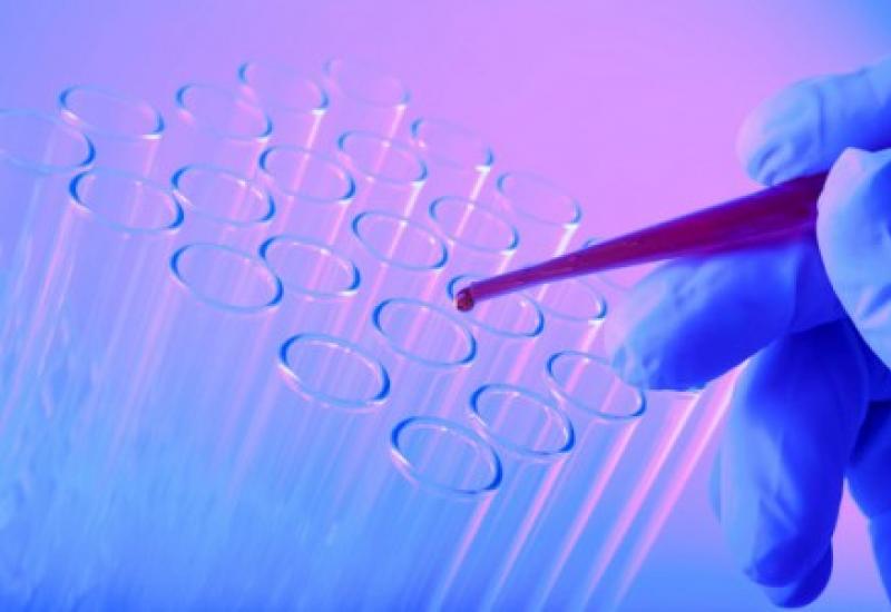 Биопсия шейки матки: как проводится, показания к исследованию Методы исследования материала